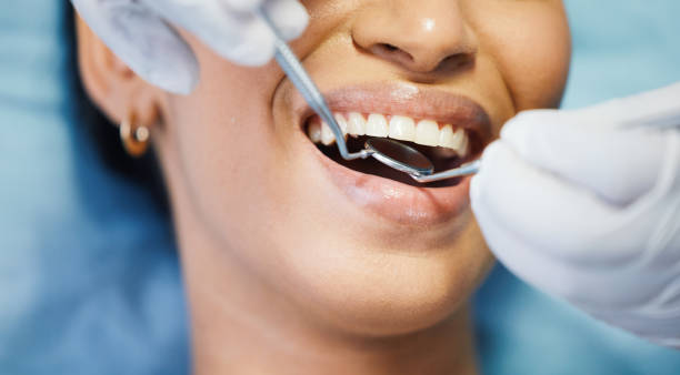 Best Emergency Dental Care for Trauma or Injury in Lake Magdalene, FL